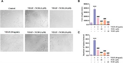 Screening and construction of nanobodies against human CD93 using phage libraries and study of their antiangiogenic effects